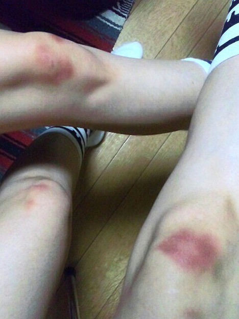 わたしと相方のかわいそすぎ 写真共有サイト フォト蔵